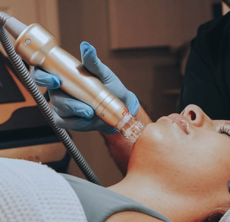 microneedlin | Aesthetic medical spa | Qulaity treatments