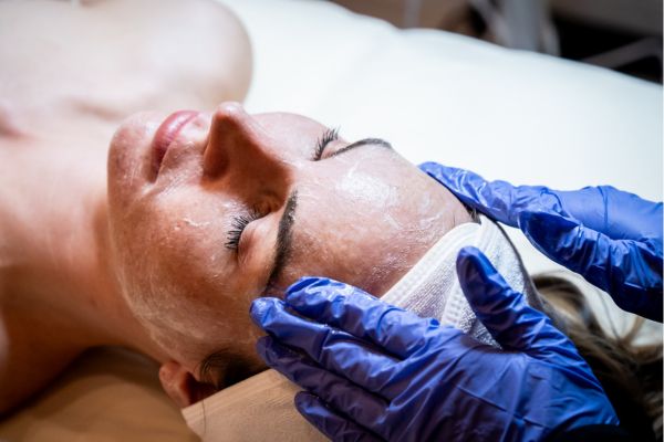 medical-grade chemical peels | Acne skincare