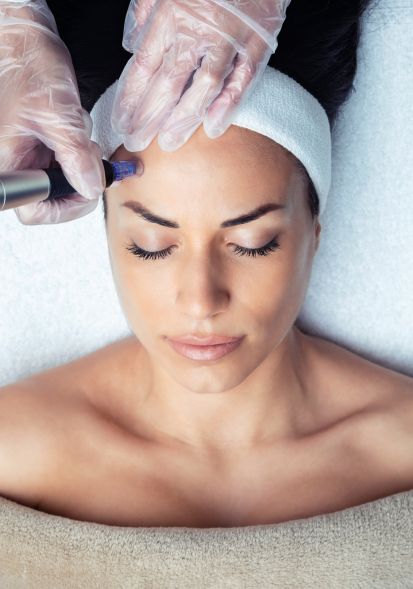 Best microneedling treatment in ornaldo