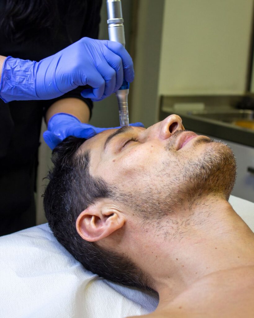 best choice treatment | no downtime | long term results | medspa microneedling
