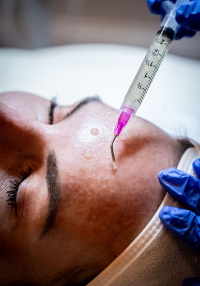Botox and dysport injectable treatments