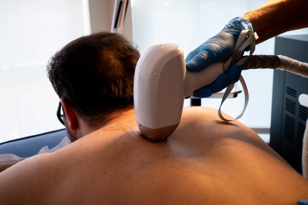 Laser treatments in ornaldo | laser skin care