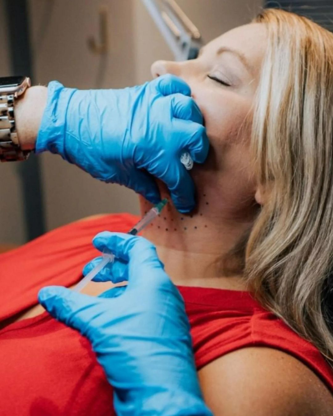 sagging and thiny skin treatment | hyperdilute radiesse injections for aging skin | above upper arms | knee| shoulders treatment
