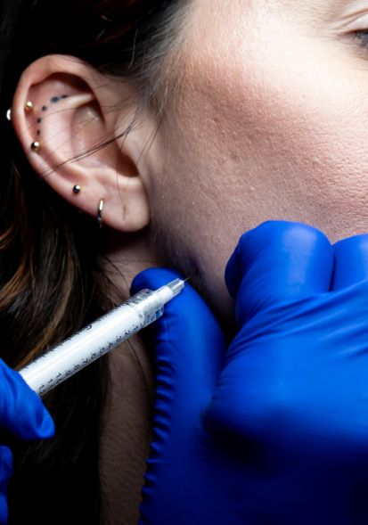 Hyperdilute radiesse treatment in for you beauty enhancement and more