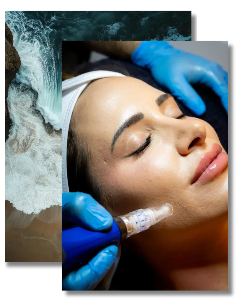 Woman Receiving A Facial Microneedling Treatment By A Professional Wearing Blue Gloves, Overlaid With Ocean Wave Imagery